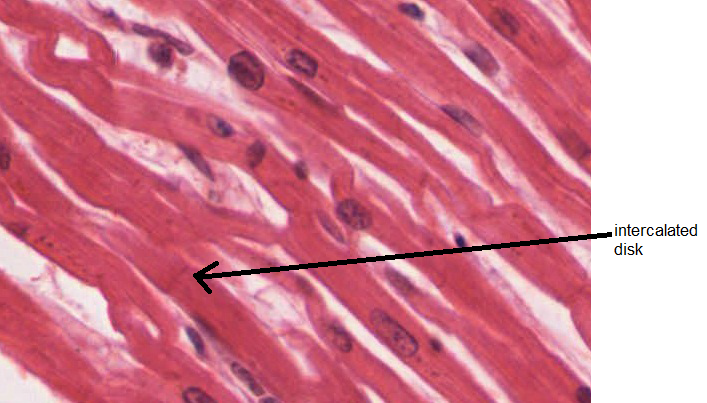 Cardiac micrograph
